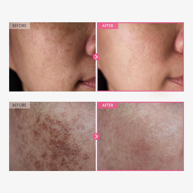 Brightening cream